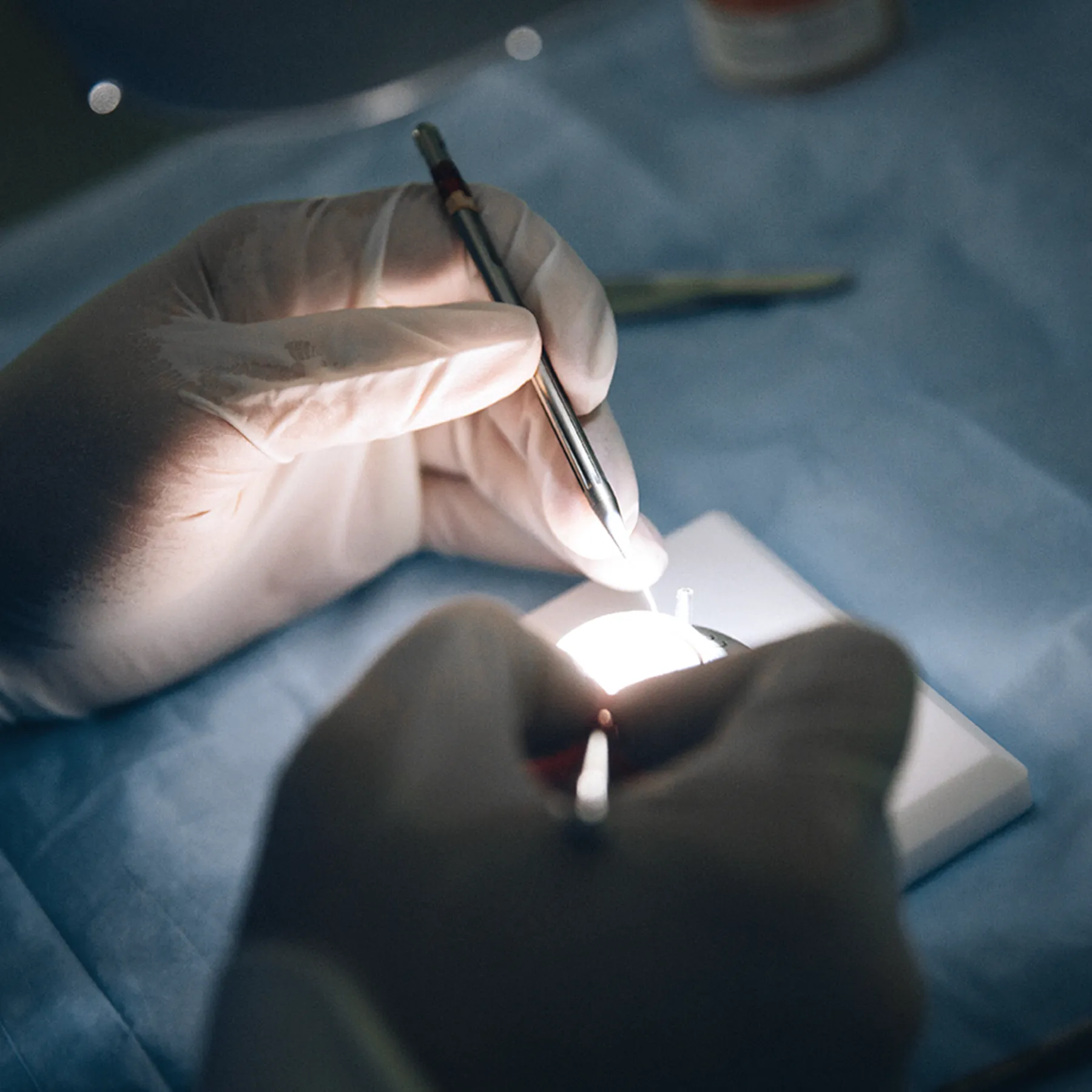 Doctor working on eye